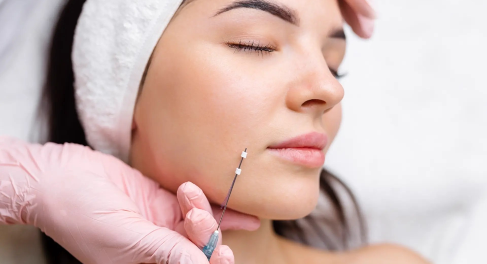 Sugar Thread Lift in Abu Dhabi Subtle Skin Lifting