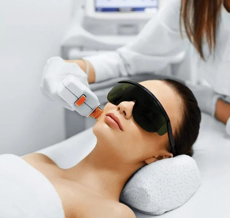 laser hair removal Edmonton